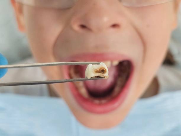 Best Holiday Emergency Dentist in Web, AL
